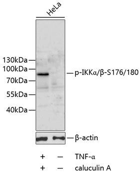 Anti-Phospho-IKK alpha/beta (Ser176/180) Rabbit Polyclonal Antibody