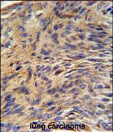 Anti-GRP78 BiP Rabbit Polyclonal Antibody