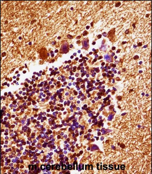 Anti-MAP2K4 Rabbit Polyclonal Antibody