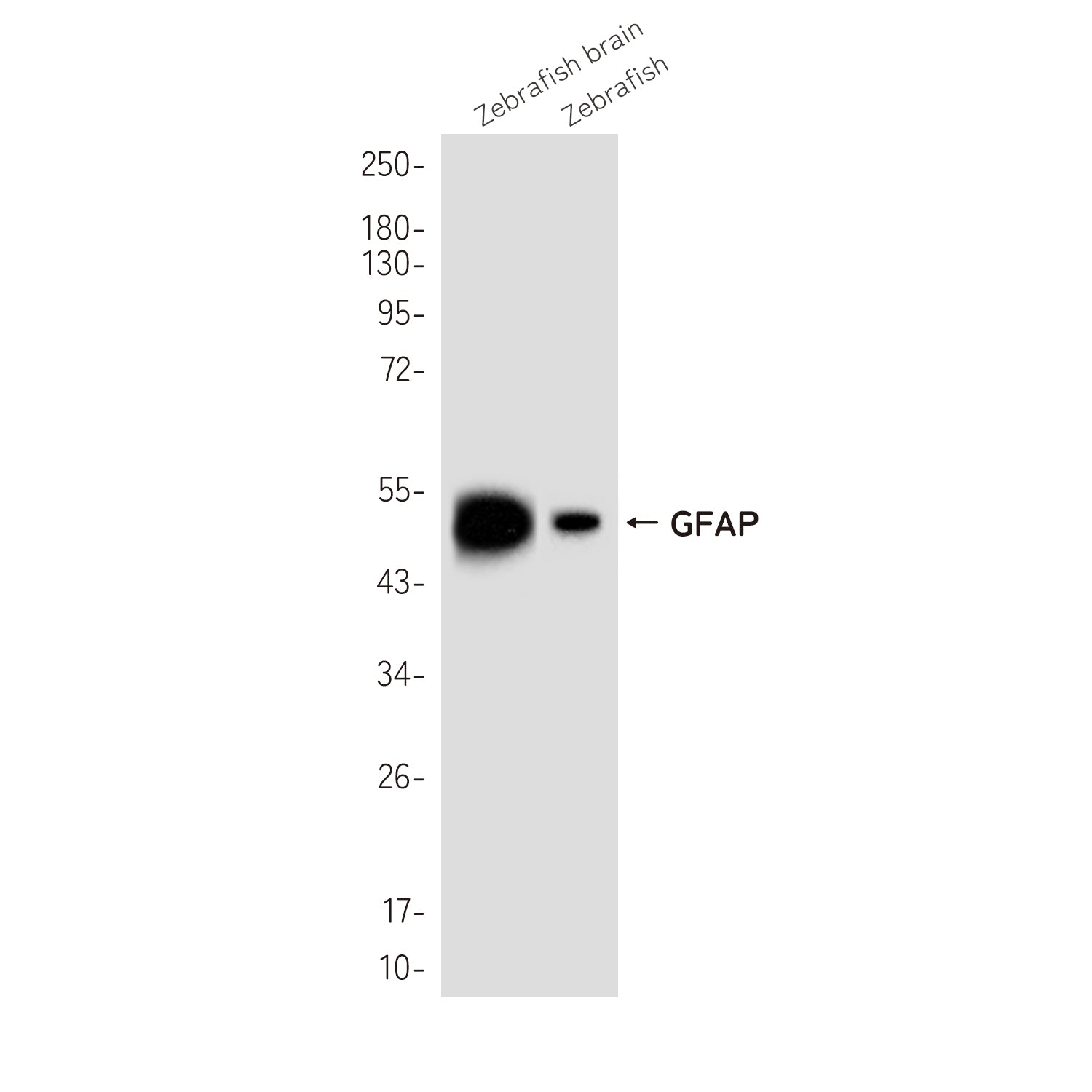 Anti-GFAP Rabbit Polyclonal Antibody