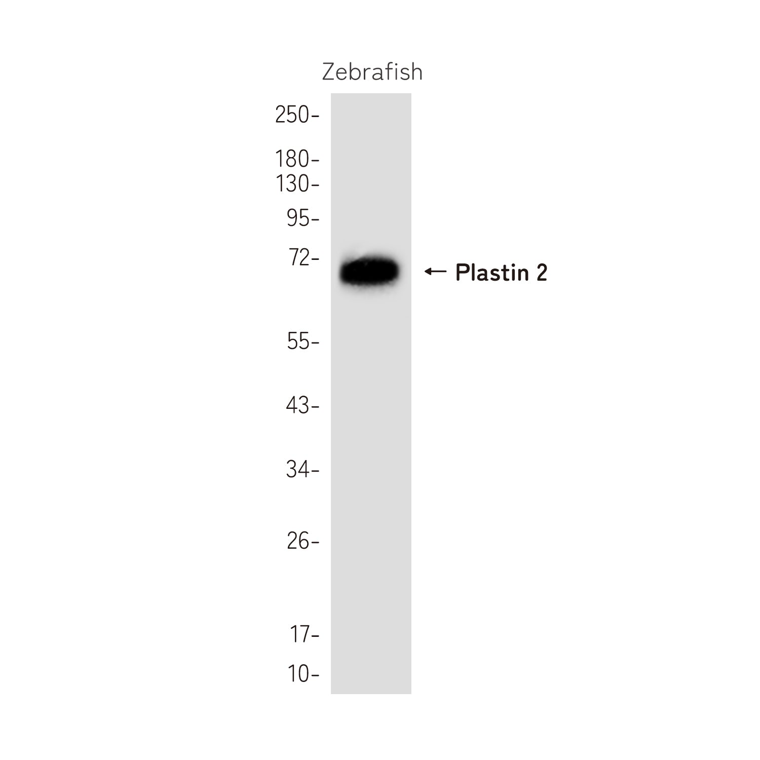 Anti-Plastin 2 Rabbit Polyclonal Antibody