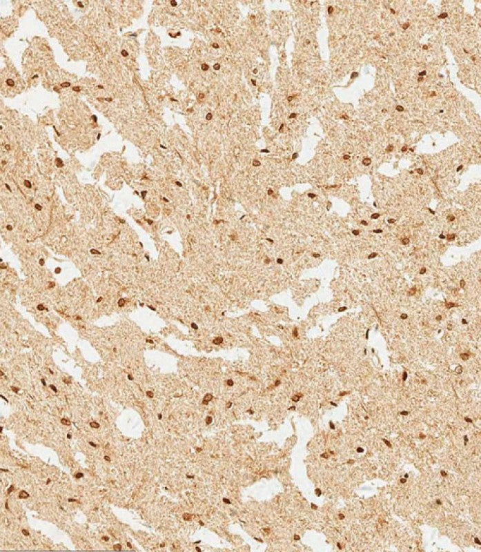 Anti-WDR82 Rabbit Polyclonal Antibody