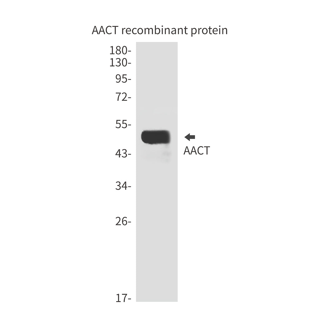 Anti-AACT Mouse Monoclonal Antibody