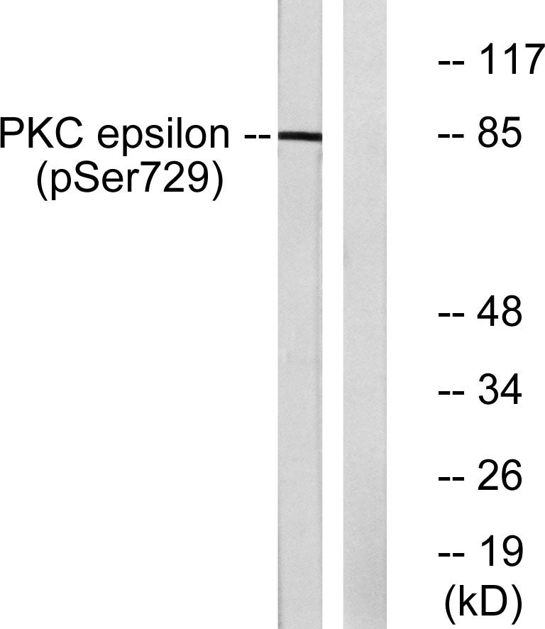 Anti-Phospho-PKC epsilon (Ser729) Rabbit Polyclonal Antibody