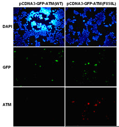 Anti-ATM(F858L Mutant) Mouse Monoclonal Antibody