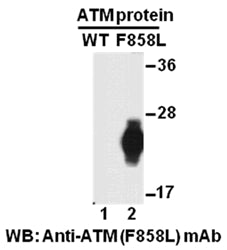 Anti-ATM(F858L Mutant) Mouse Monoclonal Antibody