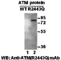 Anti-ATM(R2443Q Mutant) Mouse Monoclonal Antibody