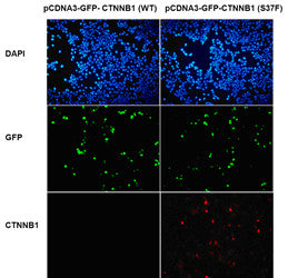 Anti-CTNNB1(S37F Mutant) Mouse Monoclonal Antibody