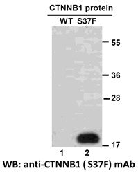 Anti-CTNNB1(S37F Mutant) Mouse Monoclonal Antibody
