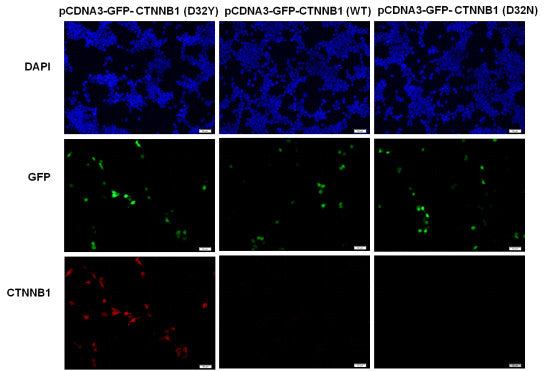 Anti-CTNNB1(D32Y Mutant) Mouse Monoclonal Antibody