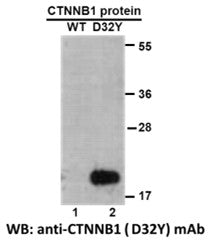 Anti-CTNNB1(D32Y Mutant) Mouse Monoclonal Antibody