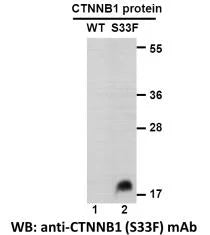 Anti-CTNNB1(S45P Mutant) Mouse Monoclonal Antibody
