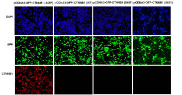 Anti-CTNNB1(S45P Mutant) Mouse Monoclonal Antibody