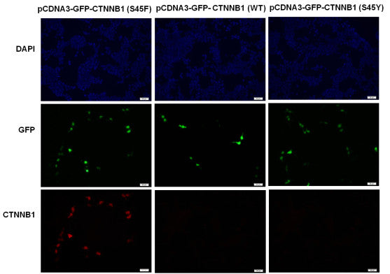 Anti-CTNNB1(S45F Mutant) Mouse Monoclonal Antibody