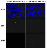 Anti-EGFR(D761Y Mutant) Mouse Monoclonal Antibody