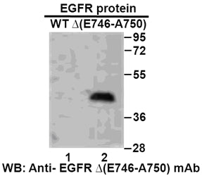 Anti-EGFR(E746-A750 Mutant)del Mouse Monoclonal Antibody