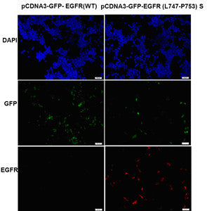 Anti-EGFR(L747-P753 Mutant)S Mouse Monoclonal Antibody