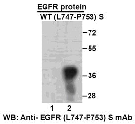 Anti-EGFR(L747-P753 Mutant)S Mouse Monoclonal Antibody