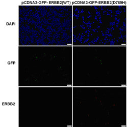 Anti-ERBB2(D769H Mutant) Mouse Monoclonal Antibody