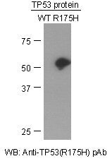 Anti-TP53(R175H Mutant) Rabbit Polyclonal Antibody