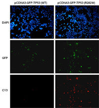 Anti-TP53(R282W Mutant) Mouse Monoclonal Antibody