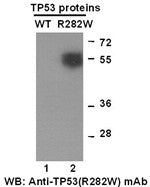 Anti-TP53(R282W Mutant) Mouse Monoclonal Antibody