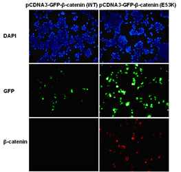 Anti-β-Catenin(E53K Mutant) Mouse Monoclonal Antibody