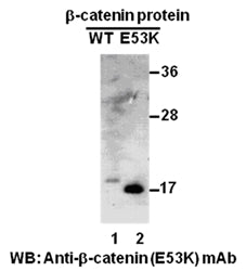 Anti-β-Catenin(E53K Mutant) Mouse Monoclonal Antibody