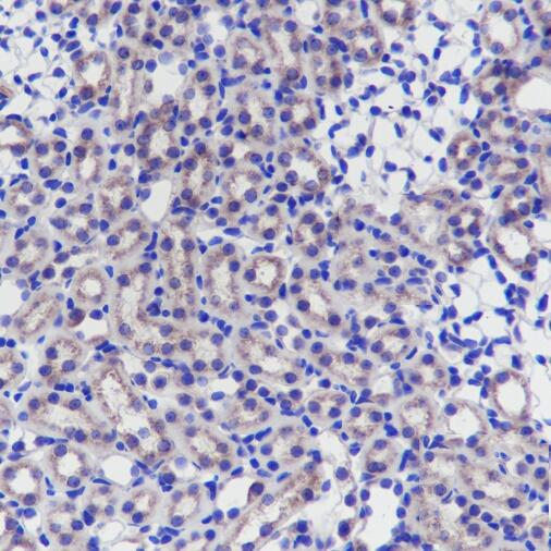 Anti-Mitofusin 1 Mouse Monoclonal Antibody