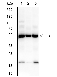 Anti-HARS Mouse Monoclonal Antibody