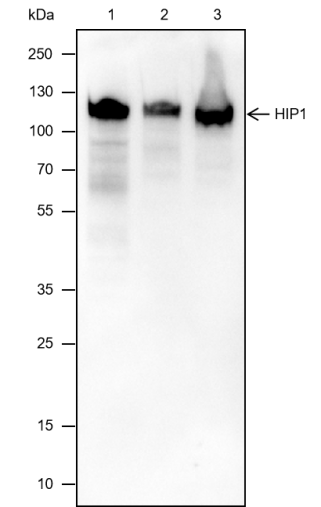 Anti-HIP1 Mouse Monoclonal Antibody