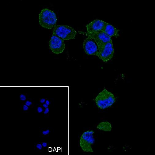 Anti-HIP1 Mouse Monoclonal Antibody