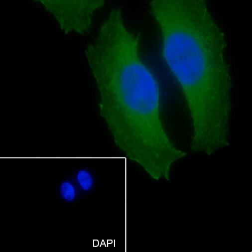Anti-PHGDH Mouse Monoclonal Antibody
