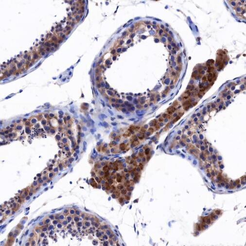 Anti-ATG13 Mouse Monoclonal Antibody