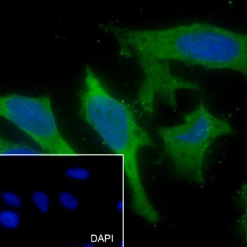 Anti-KRAS Mouse Monoclonal Antibody