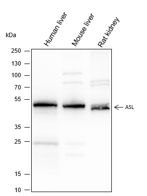 Anti-ASL Mouse Monoclonal Antibody