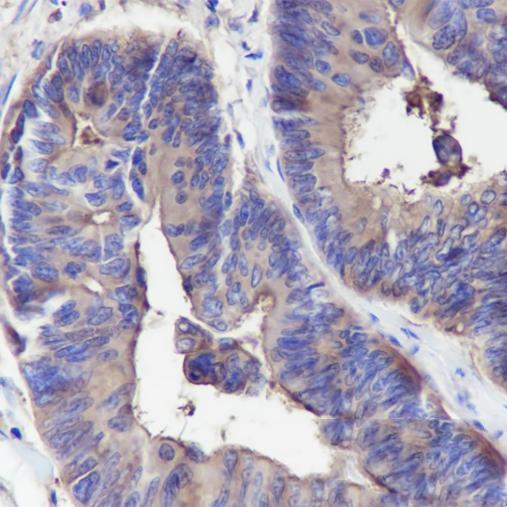 Anti-CD66a Mouse Monoclonal Antibody