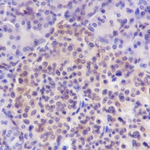 Anti-ENO3 Mouse Monoclonal Antibody