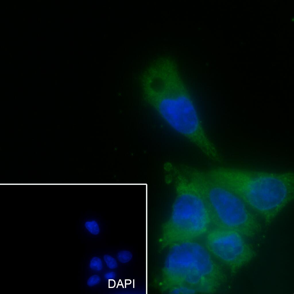 Anti-ENO3 Mouse Monoclonal Antibody