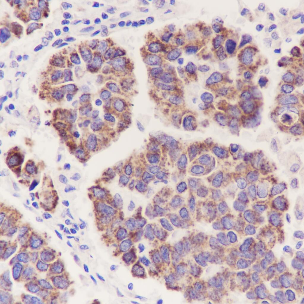 Anti-LRPPRC Mouse Monoclonal Antibody