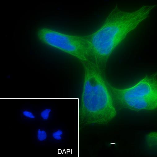 Anti-LRPPRC Mouse Monoclonal Antibody