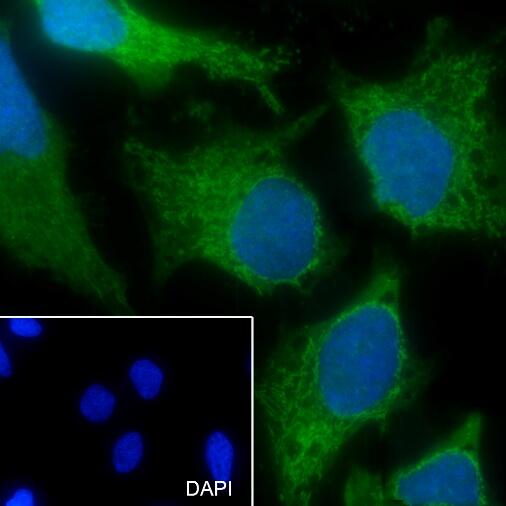 Anti-ATP5O Mouse Monoclonal Antibody