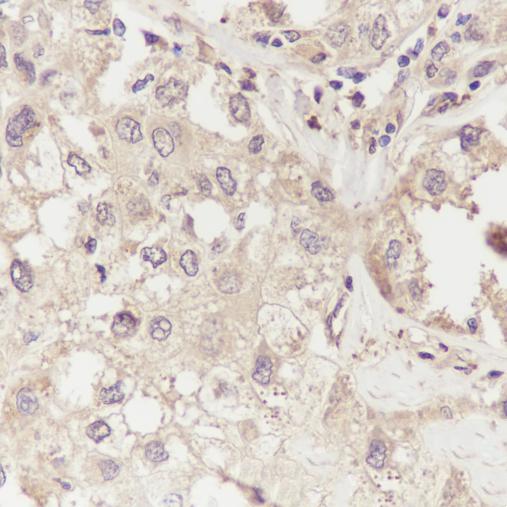 Anti-GCLM Mouse Monoclonal Antibody