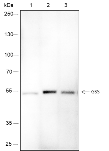 Anti-GSS Mouse Monoclonal Antibody