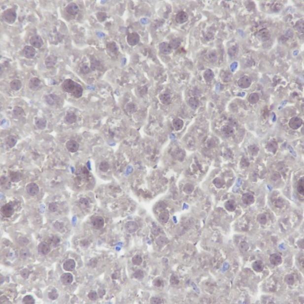 Anti-GSS Mouse Monoclonal Antibody
