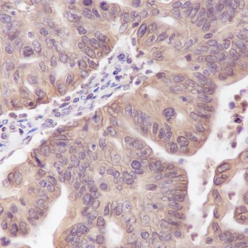 Anti-CCT8 Mouse Monoclonal Antibody