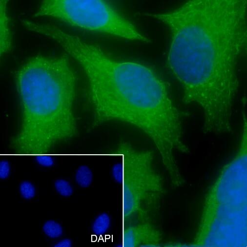 Anti-CCT8 Mouse Monoclonal Antibody