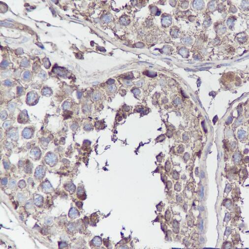 Anti-BCAR1 Mouse Monoclonal Antibody