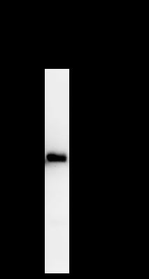 Anti-alpha-Cardiac Actin/ACTC1 Mouse Monoclonal Antibody