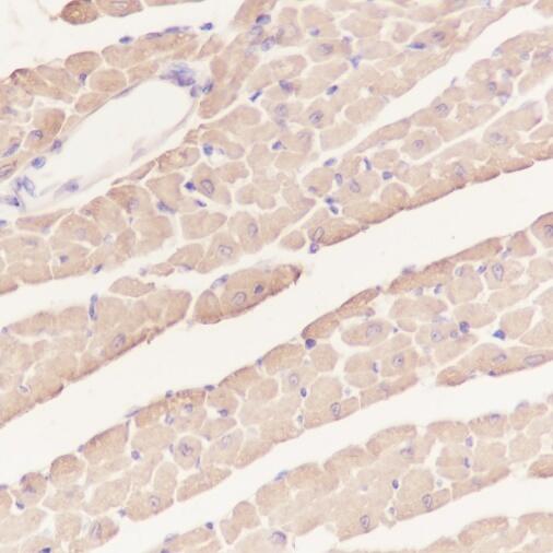 Anti-alpha-Cardiac Actin/ACTC1 Mouse Monoclonal Antibody